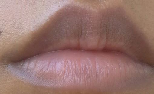 How to get rid of dark lips fast permanently naturally overnight