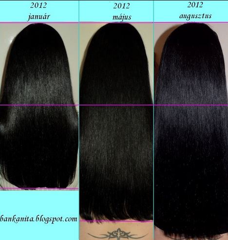 Biotin for hair growth before after pictures. Image source - Lalet' Blog