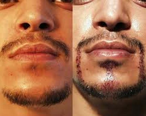 Biotin hair growth for men's facial hair