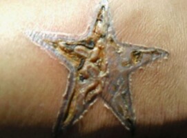 Infected tattoos images