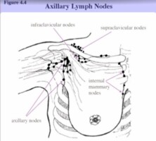 Lump Under Armpit, Painful, Hard Male, Female Sore Small, Red, Swollen ...