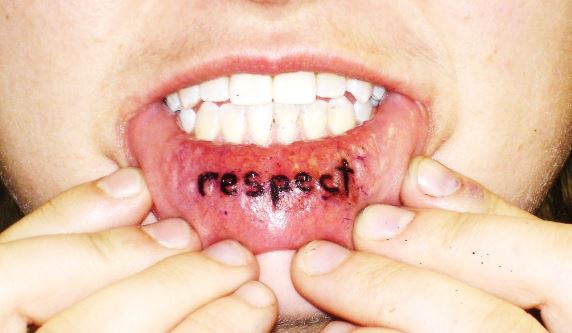 The lower lip may swell from a lit tattoo procedure
