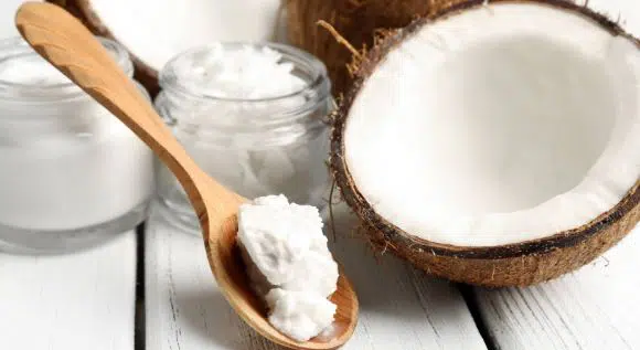 Coconut oil remedies for white stretch marks and silver stripes