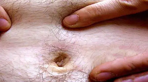 Belly button gunk may smell bad