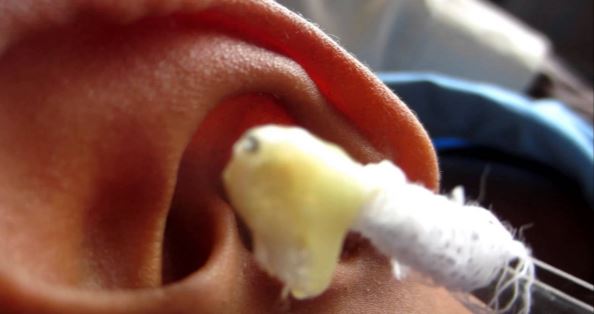 ear drainage