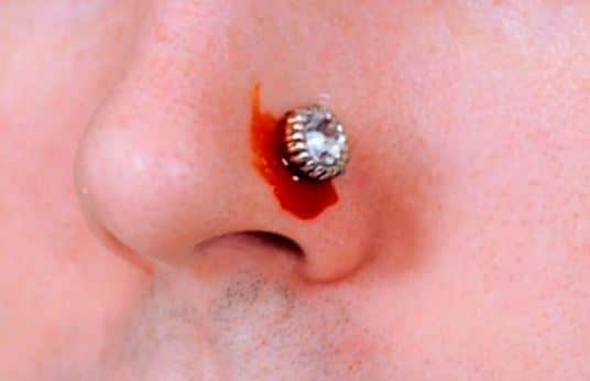 Signs of a nose piercing infection