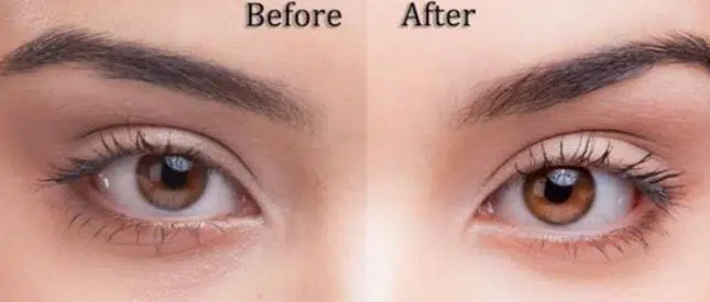 Before and after lightening eye color