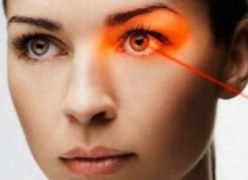 Laser surgery to change eye color permanently